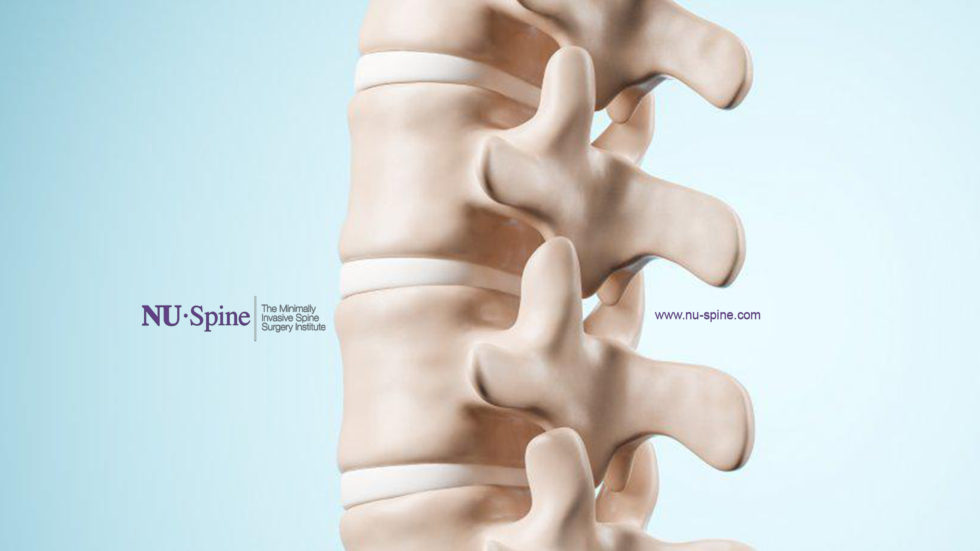 Spinal Deformity Correction Surgery in New Jersey