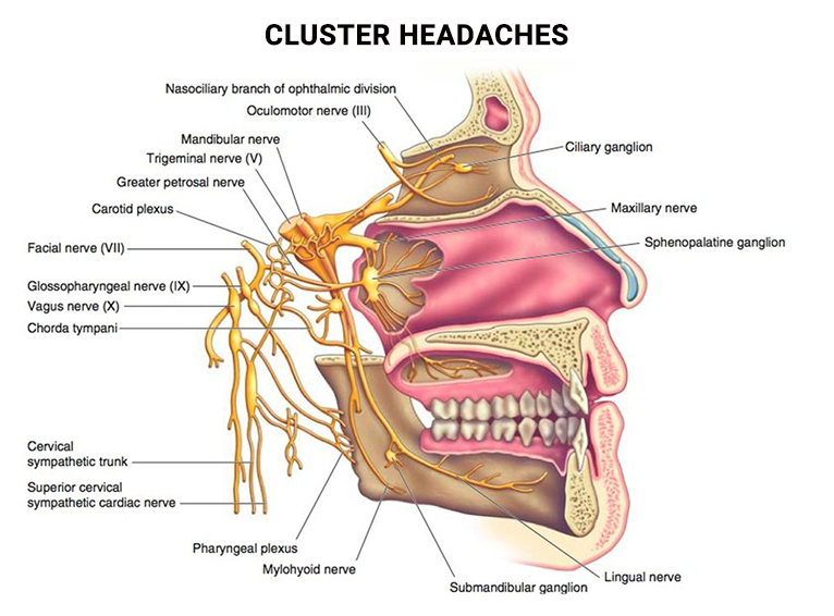 Cluster Headaches Treatment in New York