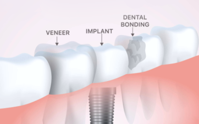 About Cosmetic Dentistry in Brookyn