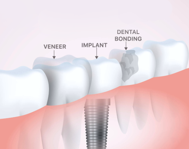 About Cosmetic Dentistry in Brookyn