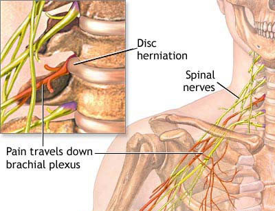 Neck Pain Treatment Specialists Doctors NYC
