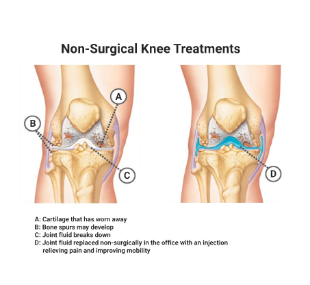 Best NYC Knee Specialists