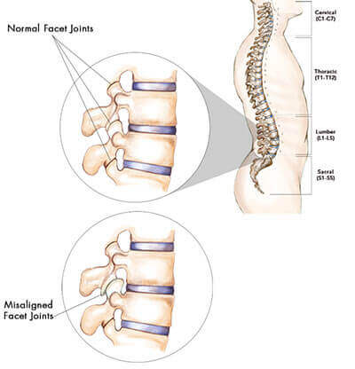 Back Pain Treatment Specialists in Brooklyn, NY