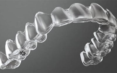 Invisalign® Invisible Braces