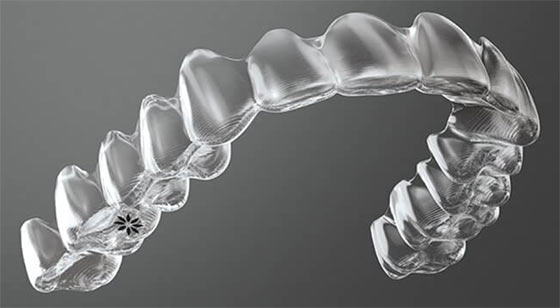 Invisalign® Invisible Braces