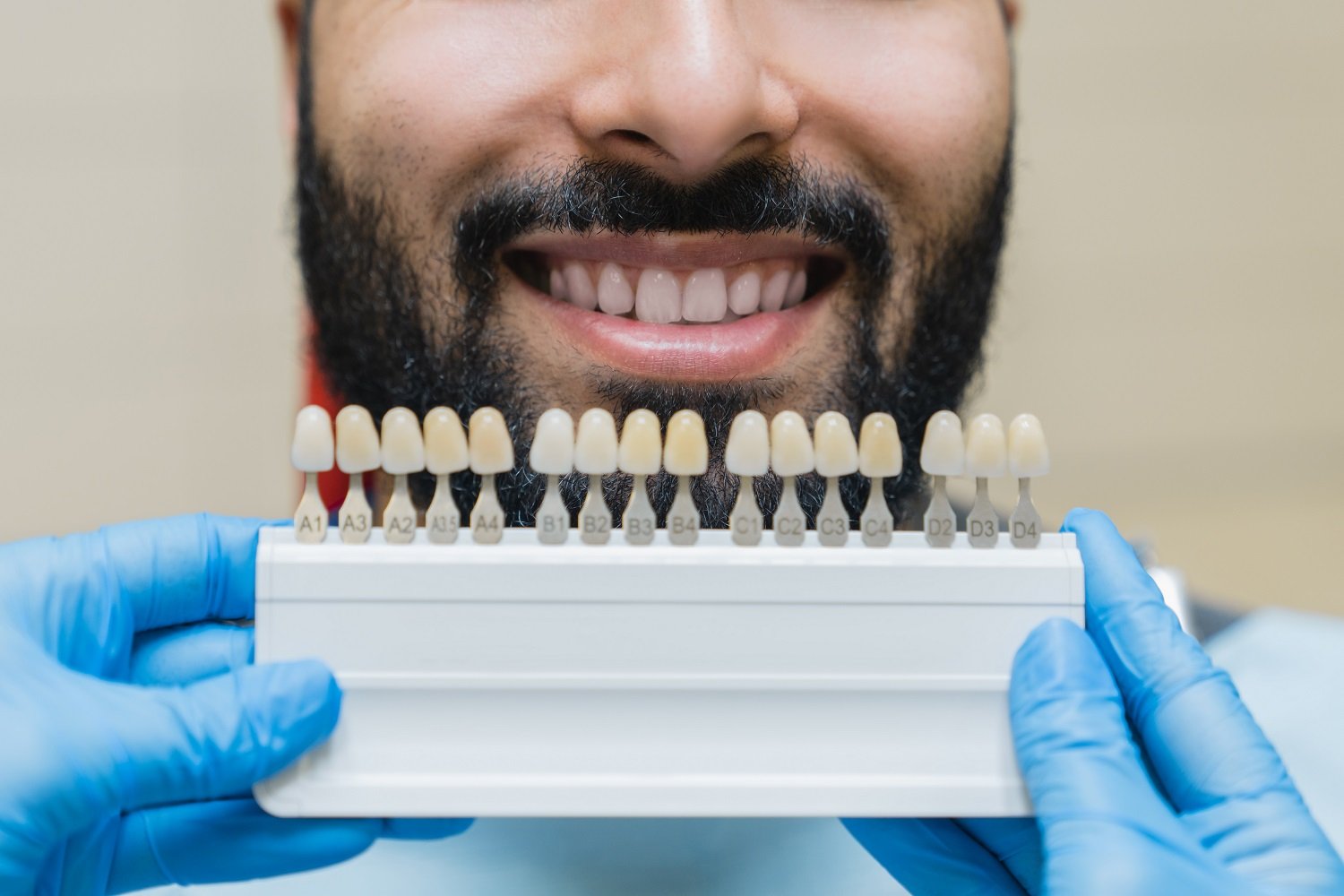 What to Know Before Whitening Your Teeth
