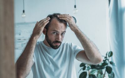 Hair Loss Awareness Month: Common Causes of Hair Loss