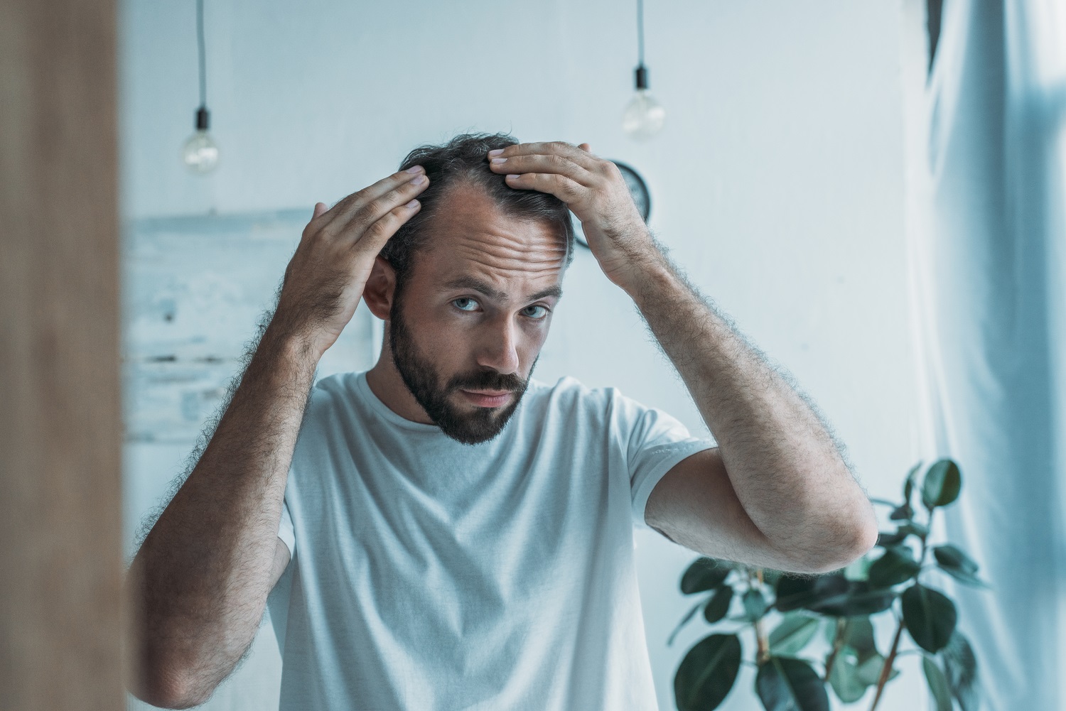 Hair Loss Awareness Month: Common Causes of Hair Loss