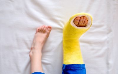 What to Expect When Your Child Breaks a Bone