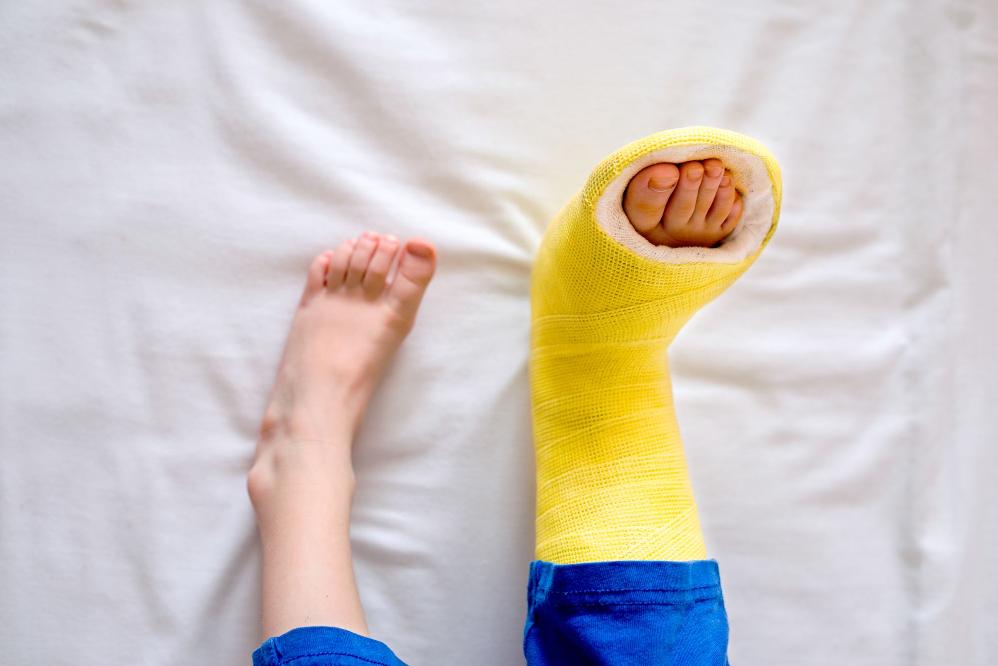 What to Expect When Your Child Breaks a Bone