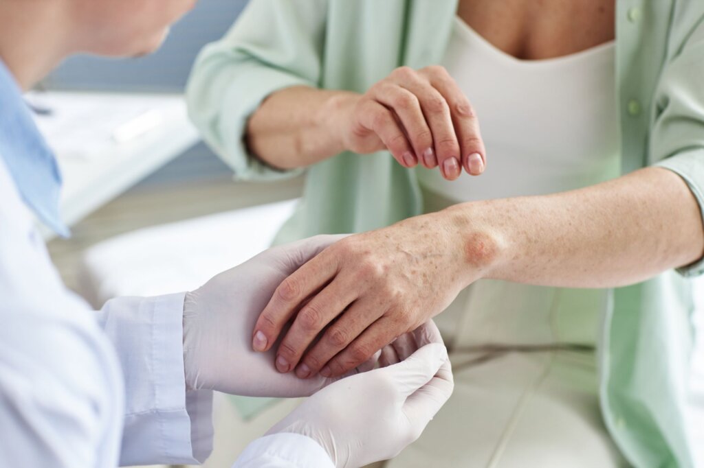 Allergy Skin Condition