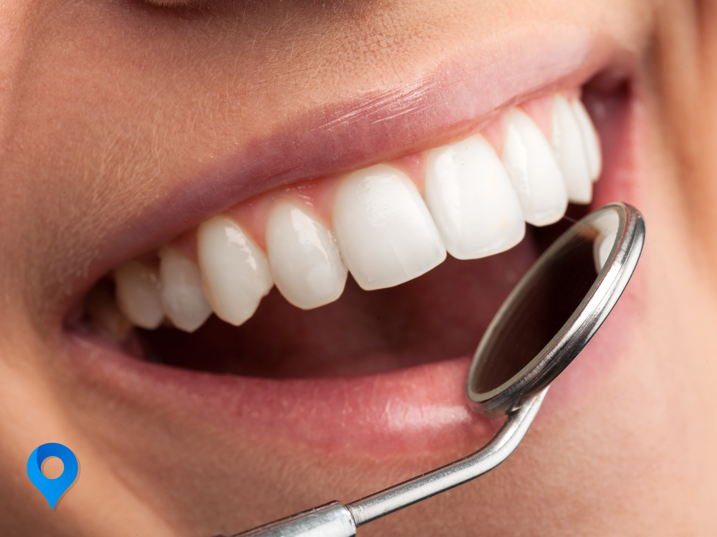 The Importance of Regular Dental Check-Ups: How Often Should You Visit the Dentist?