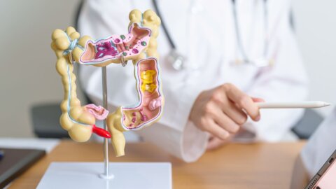 National Colorectal Cancer Awareness Month: Why Screening Matters