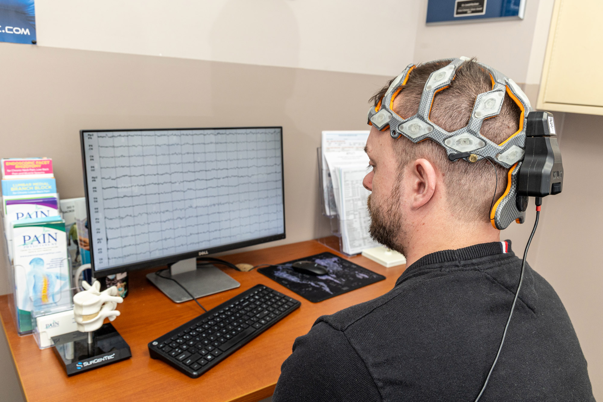 Electroencephalogram Test (EEG)Your doctor may be able to