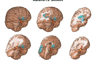 Psychotherapy for AddictionWhen you continue to use drugs, alcohol,