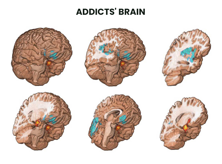 Psychotherapy for AddictionWhen you continue to use drugs, alcohol,