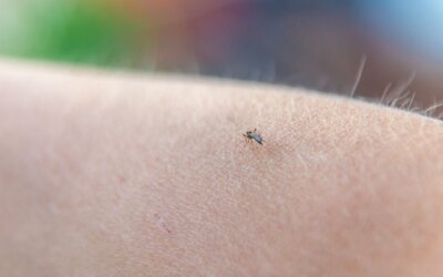 Bug Bites and Kids: Prevention, Treatment, and When to Worry