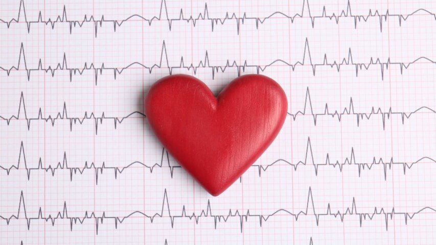 What Is Atrial Fibrillation?