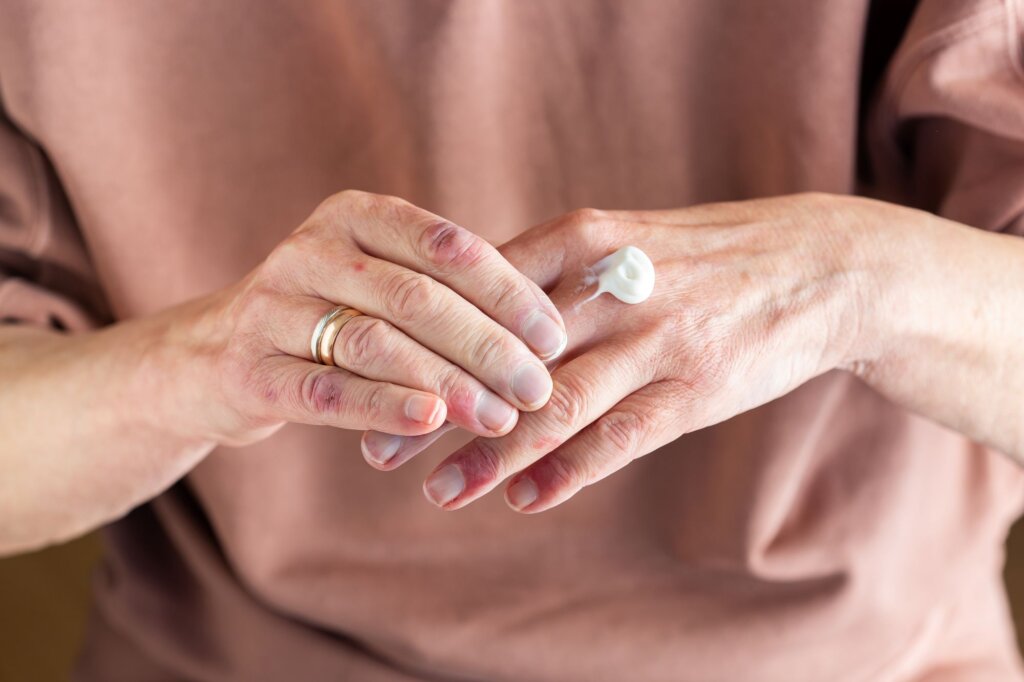 Moisturizing hands
